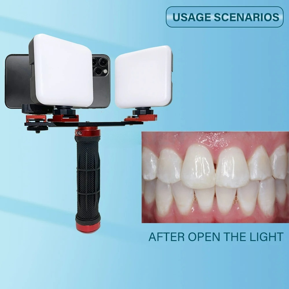 Dental Photography Light Phone – Phone Accessories For Photography recenzja i cena
